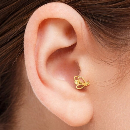 טראגוס חישוק מעיין